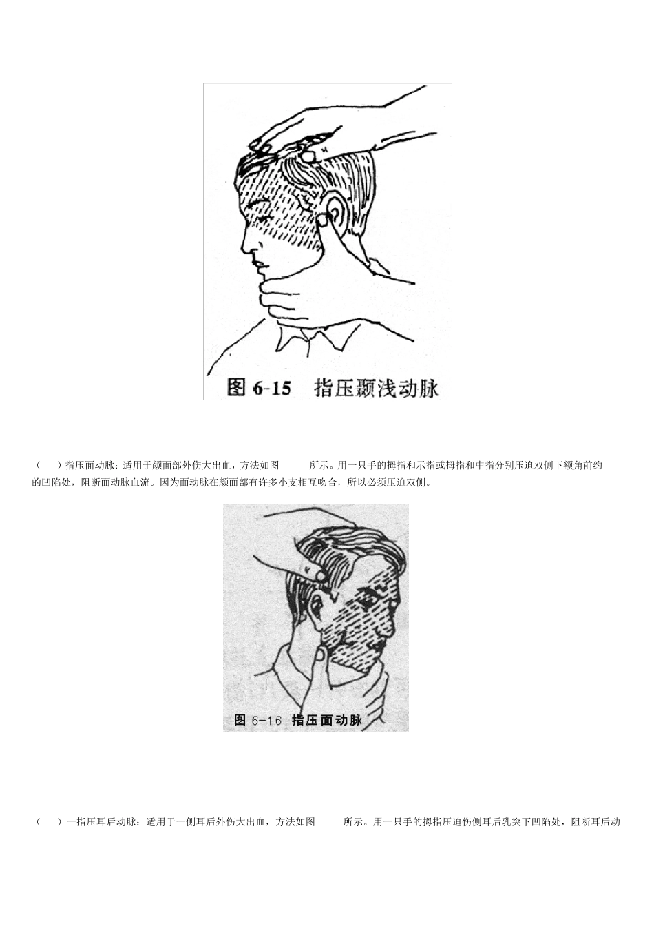 外伤急救止血_第2页