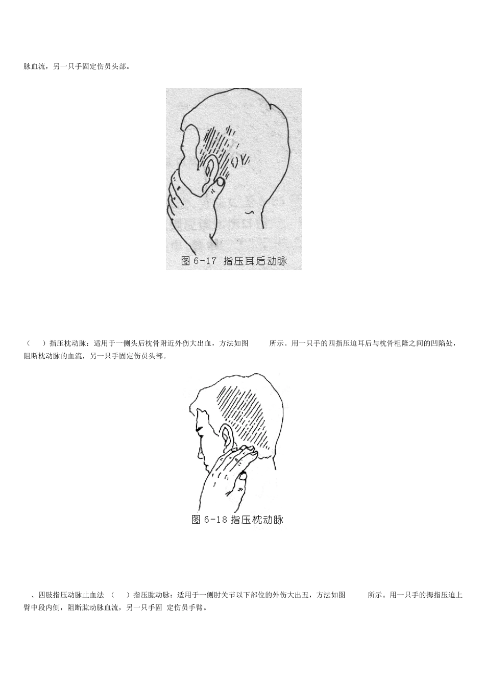 外伤急救止血_第3页