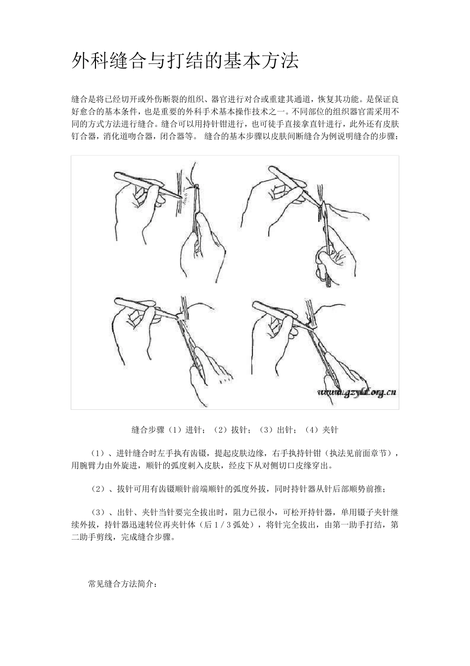 外科缝合与打结的基本方法_第1页