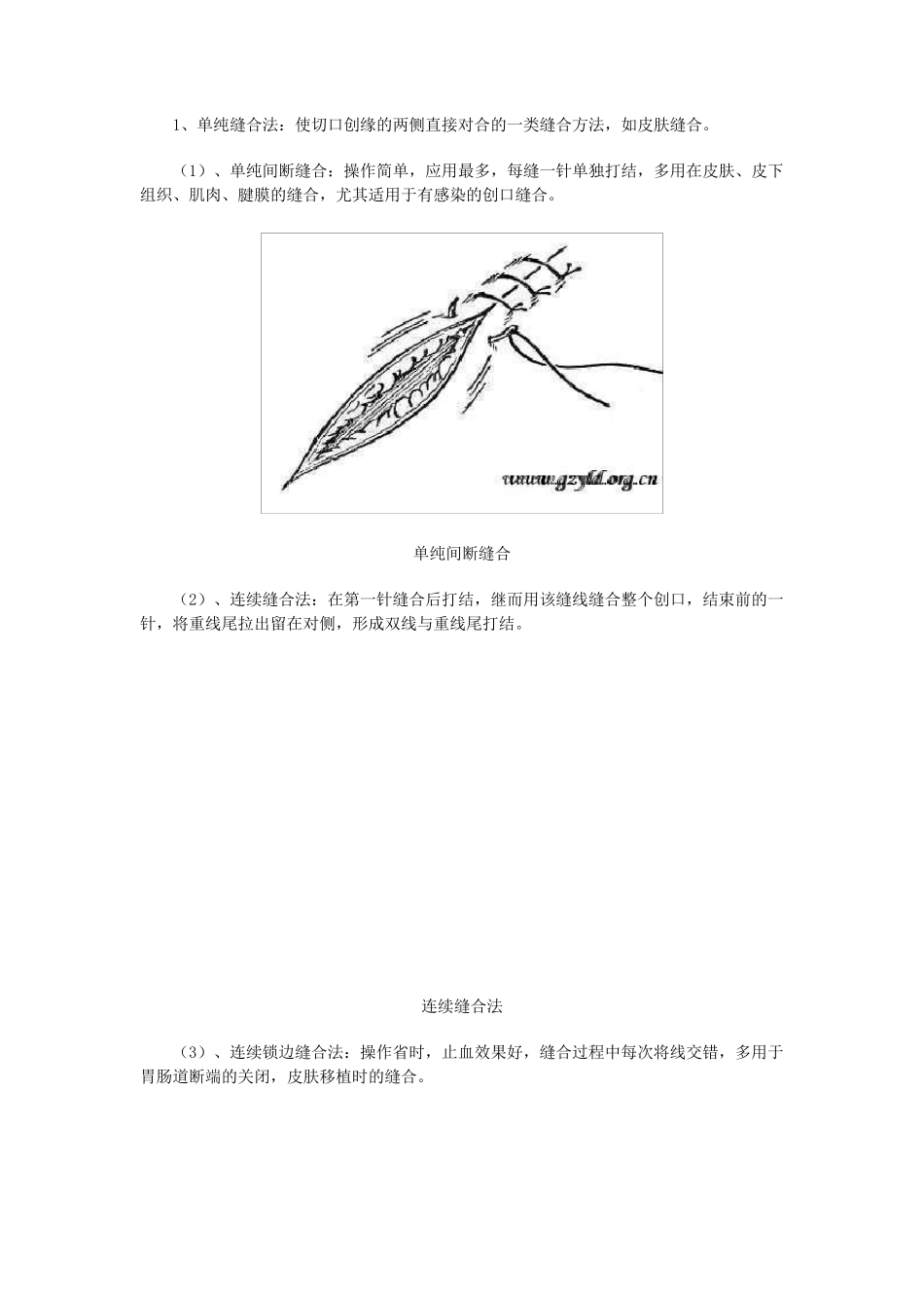 外科缝合与打结的基本方法_第2页