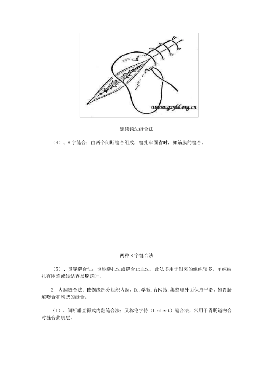 外科缝合与打结的基本方法_第3页