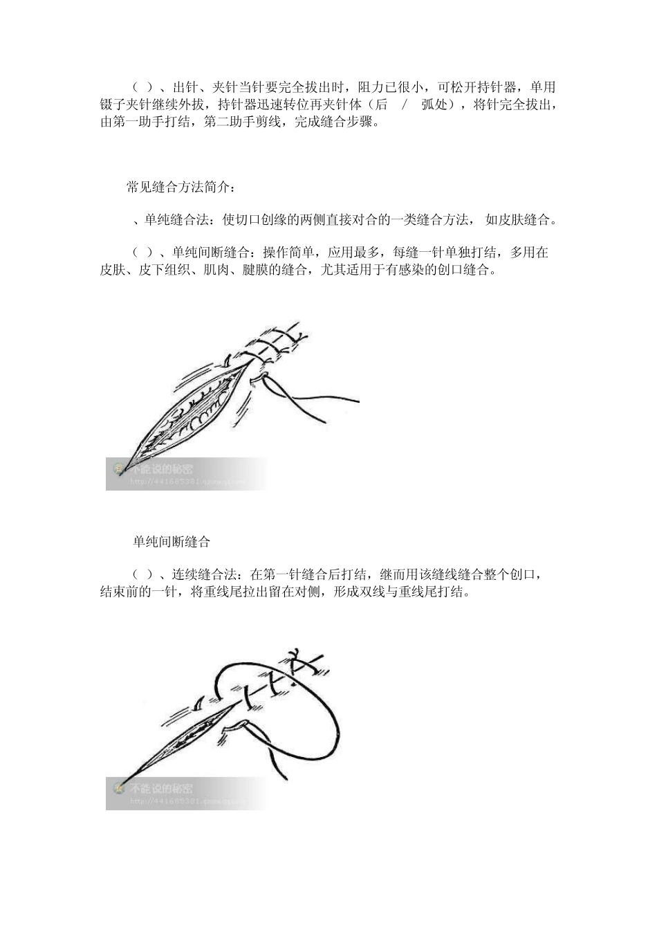 外科缝合方法_第2页