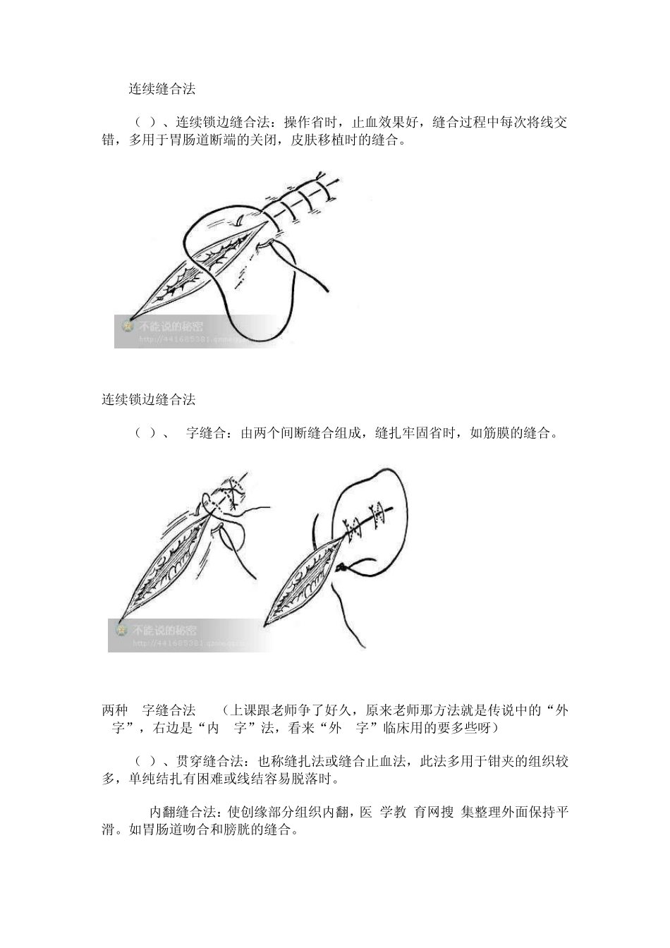 外科缝合方法_第3页