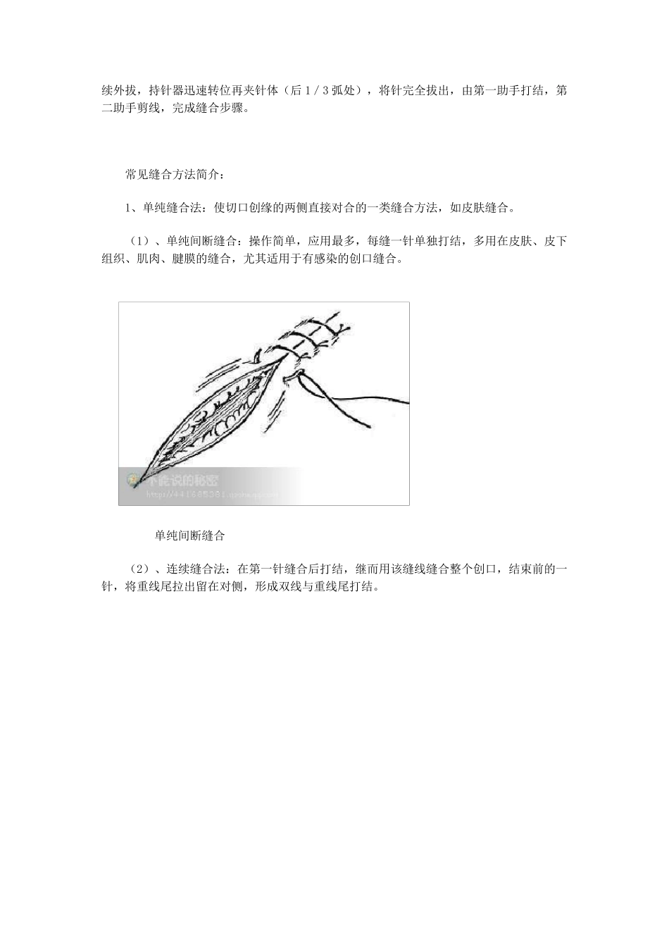 外科缝合的基本方法_第2页
