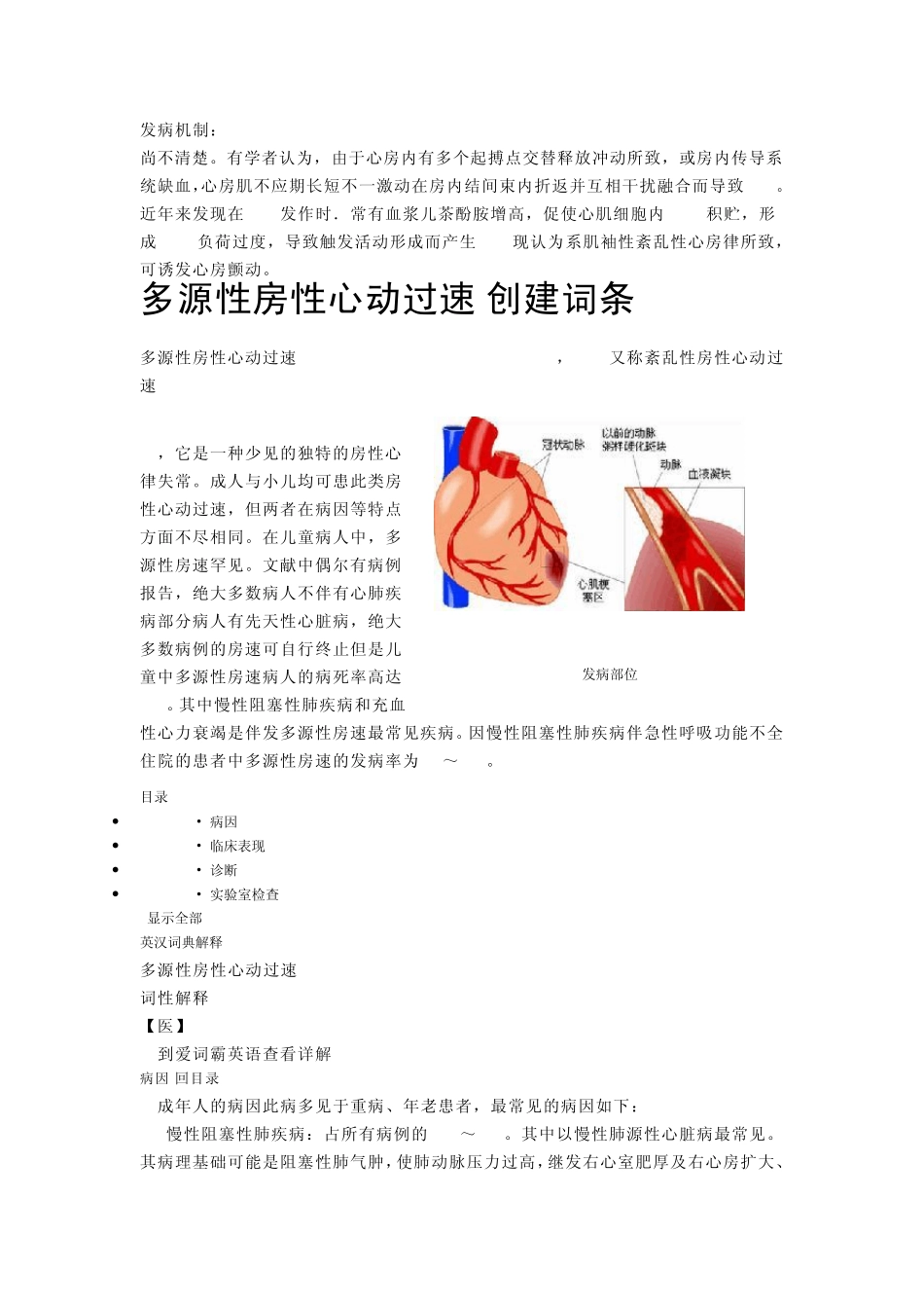 多源性房性心动过速_第2页