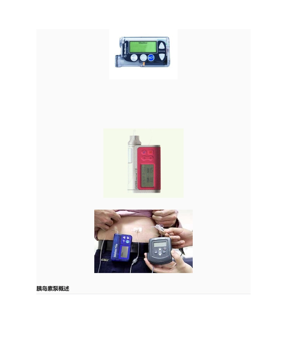2025年胰岛素泵使用及注意事项_第1页