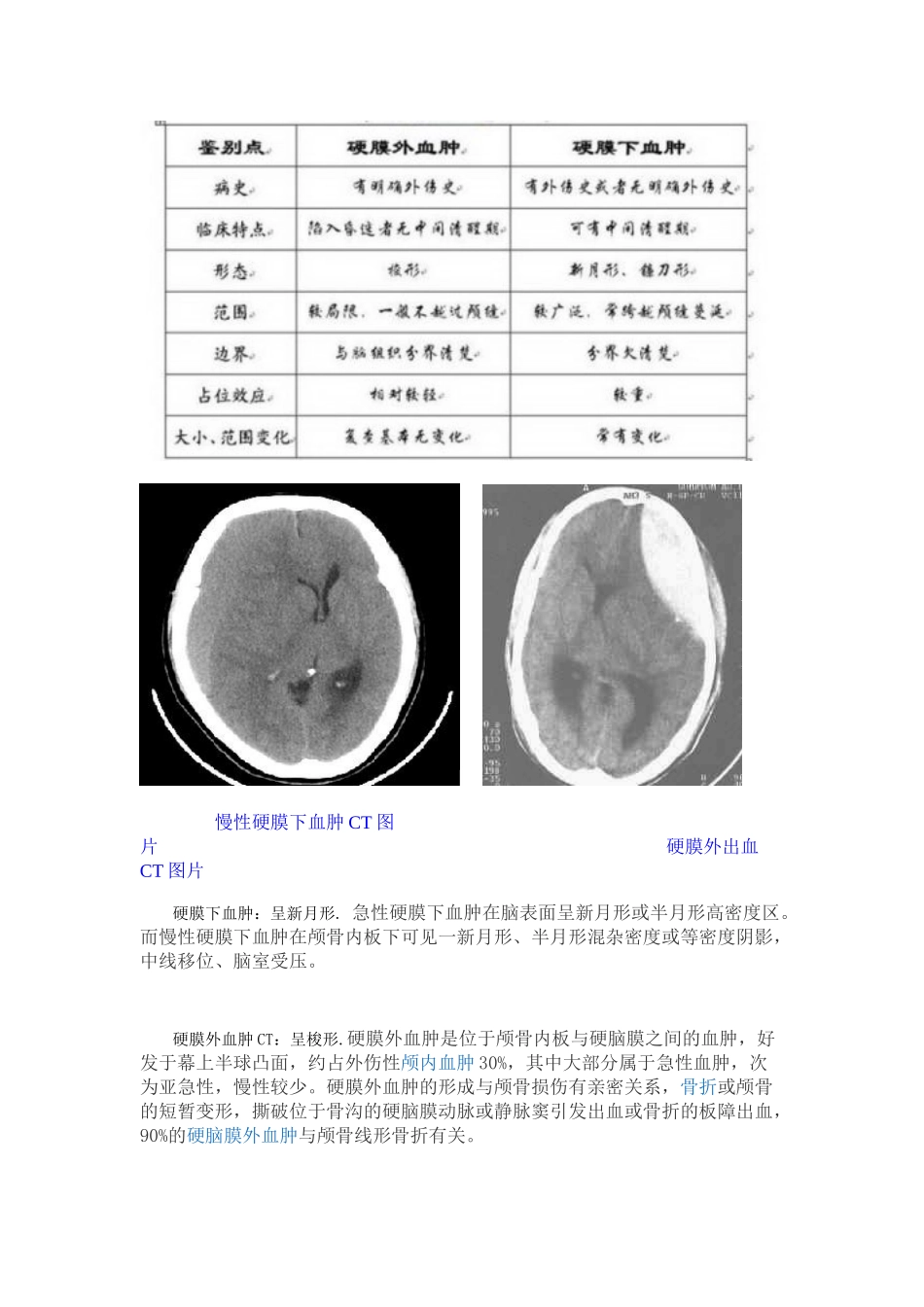 2025年硬膜下和硬膜外血肿_第2页
