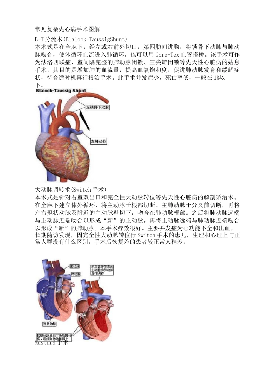 常见复杂先心病手术图解完整版_第2页