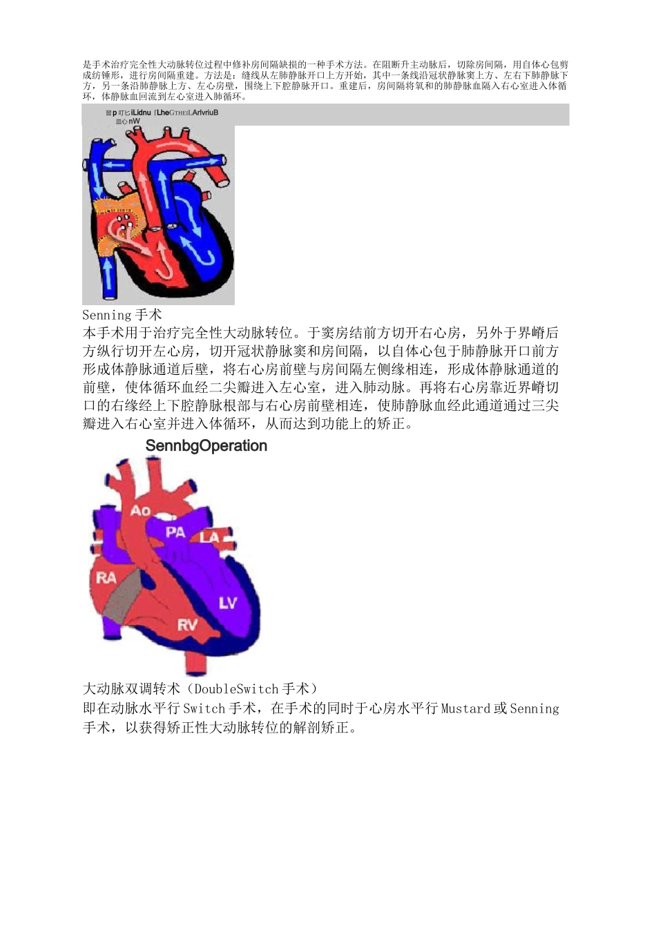 常见复杂先心病手术图解完整版_第3页
