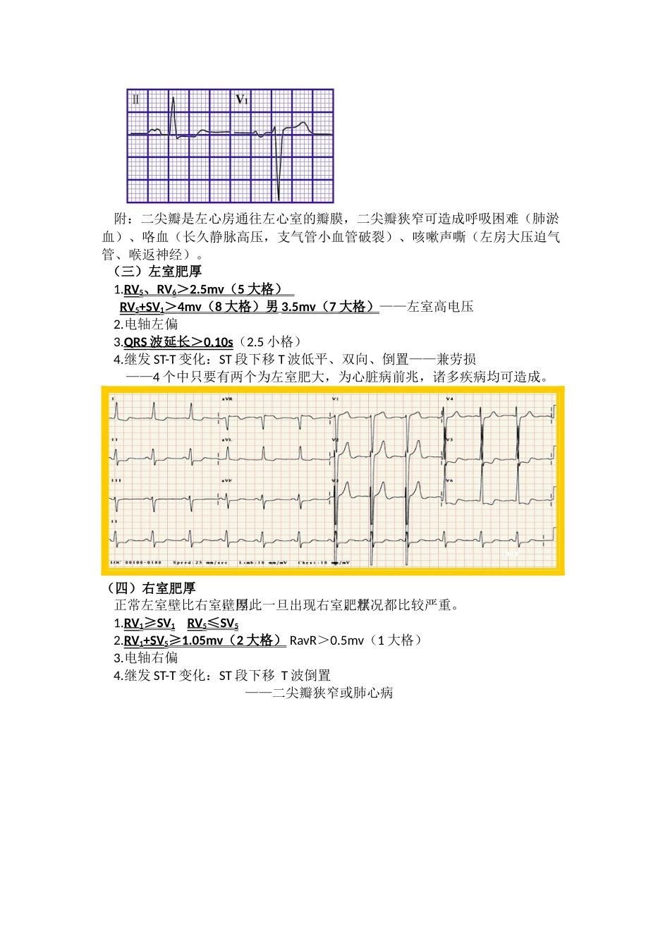 2025年心电图入门讲义_第2页