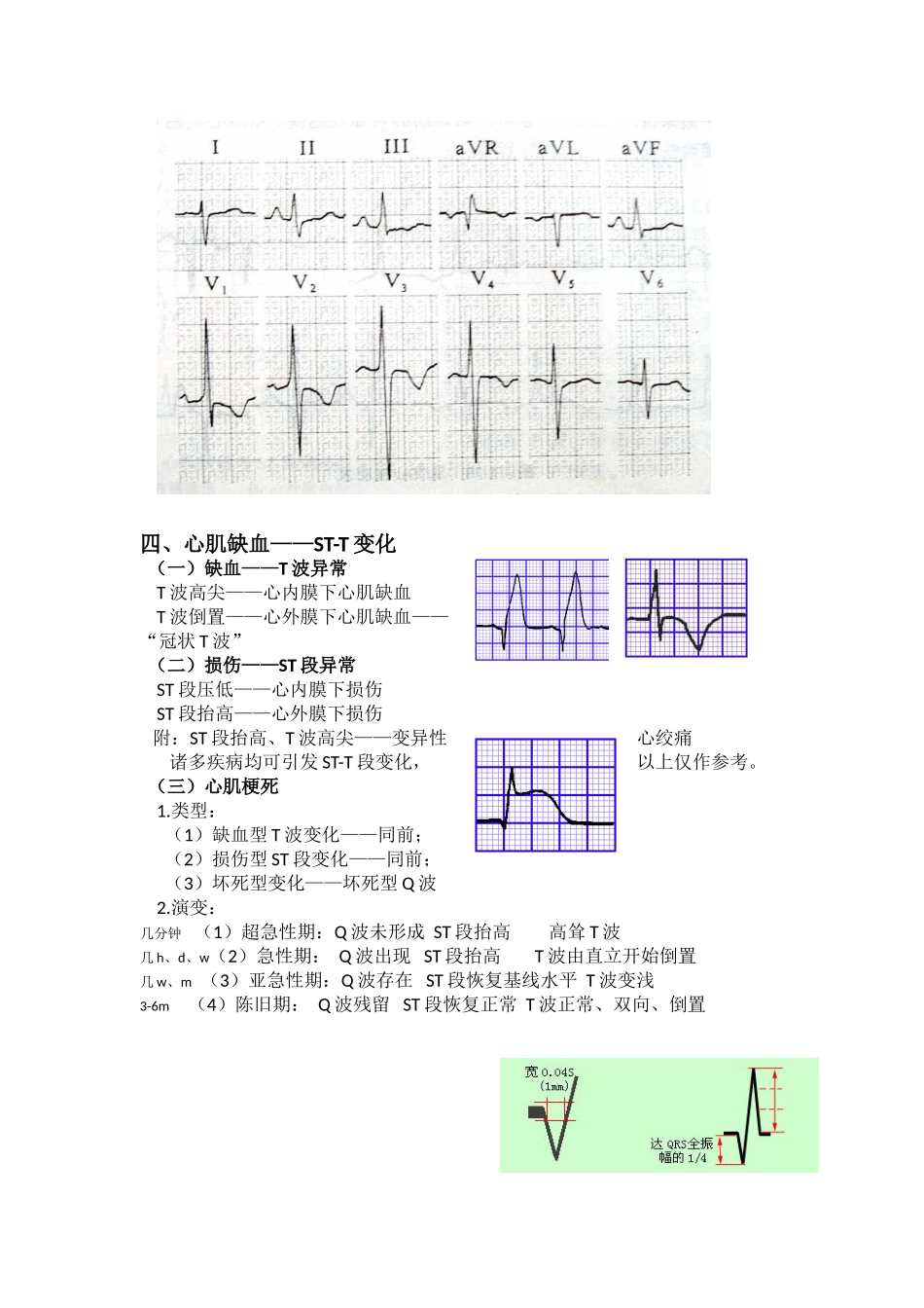 2025年心电图入门讲义_第3页