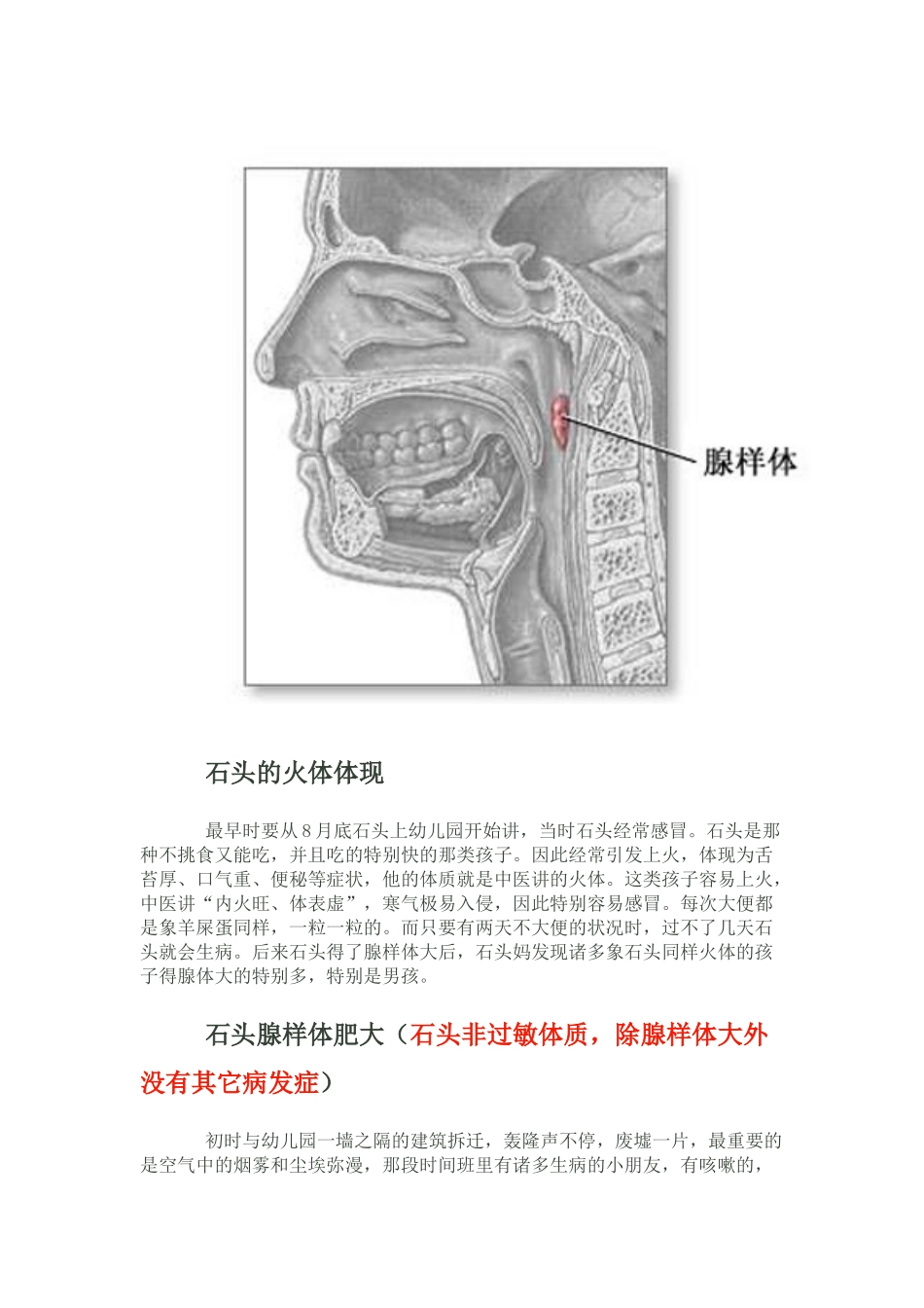 2025年腺样体治疗治愈的亲身感想及体会_第2页