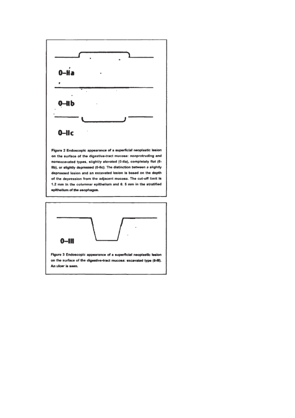 2025年消化道早癌诊治规范_第3页