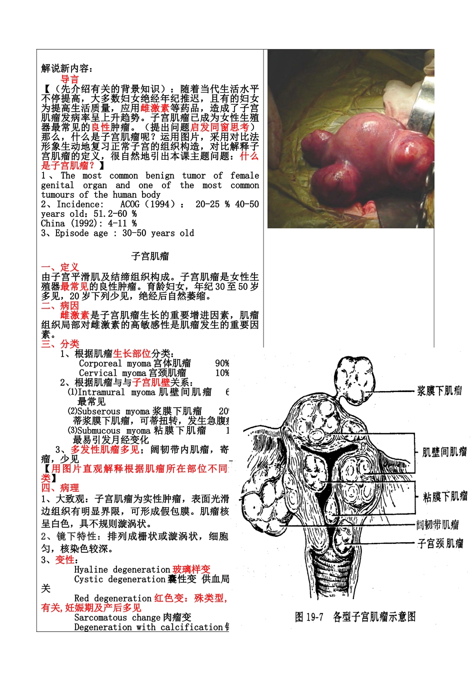 2025年子宫肌瘤_第3页