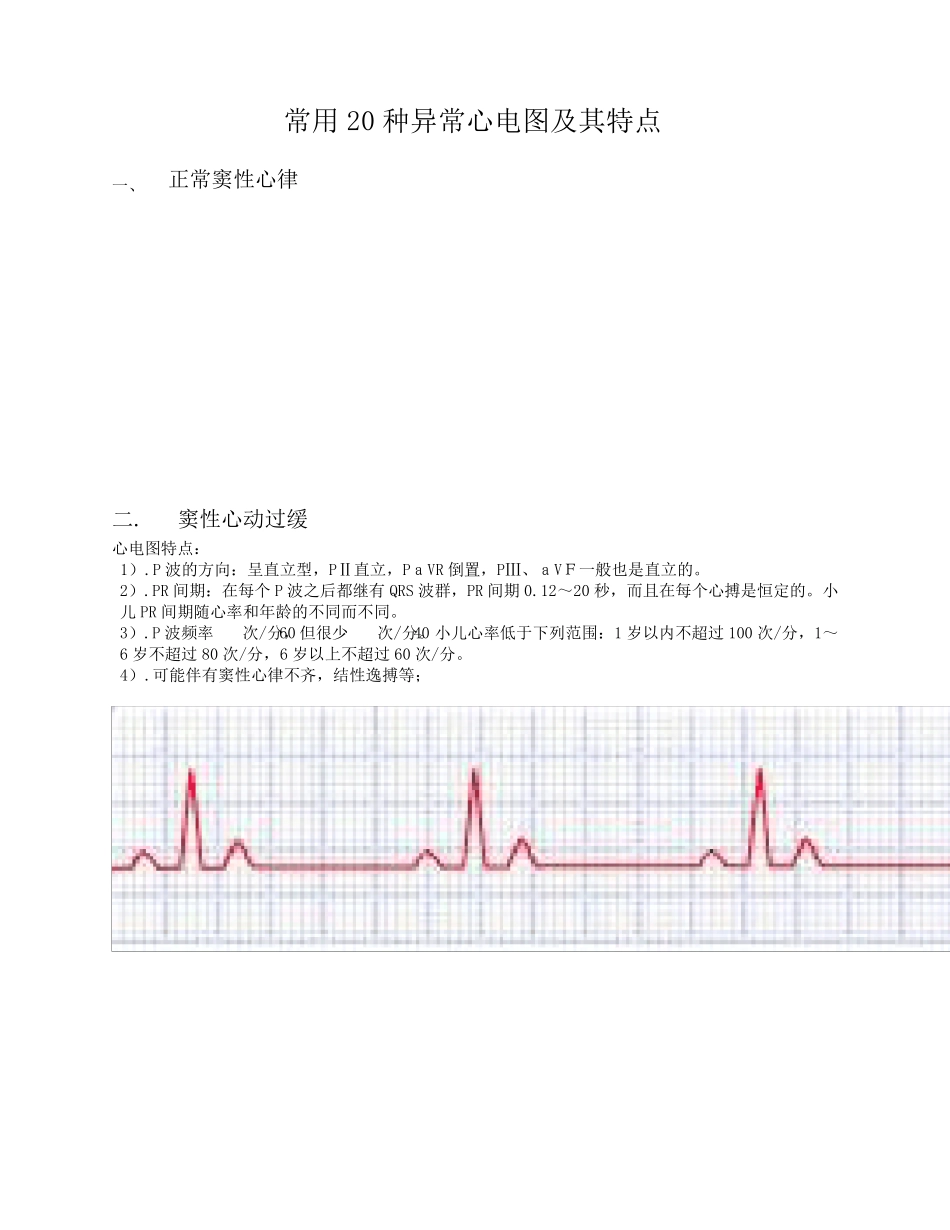 常用20种异常心电图与特点_第1页