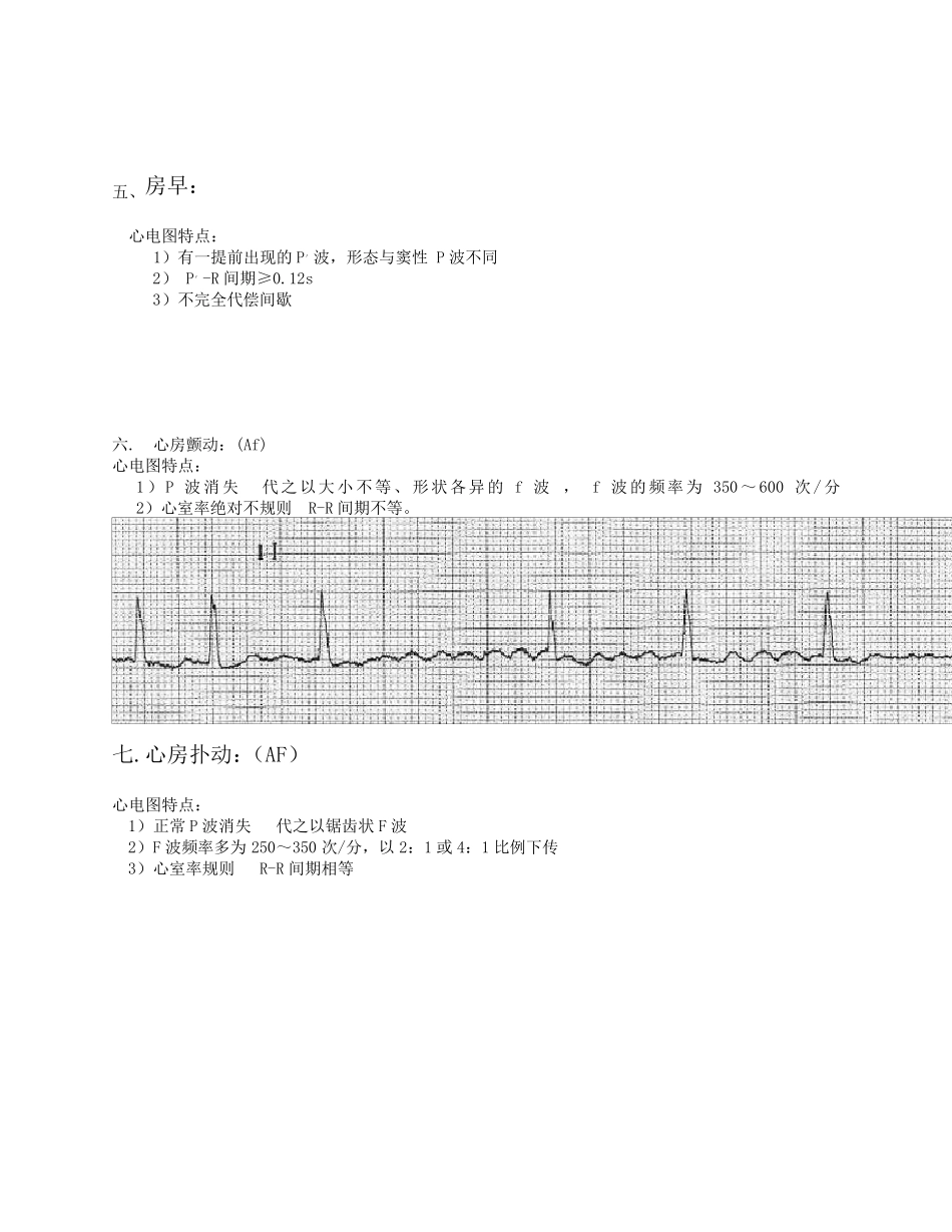 常用20种异常心电图与特点_第3页