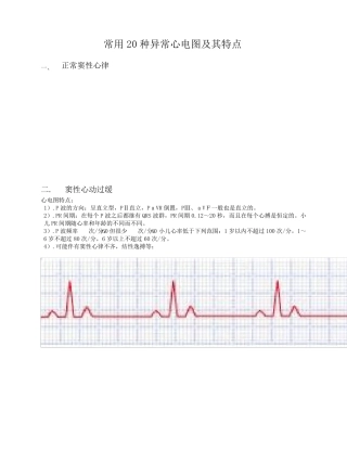 常用20种异常心电图与特点