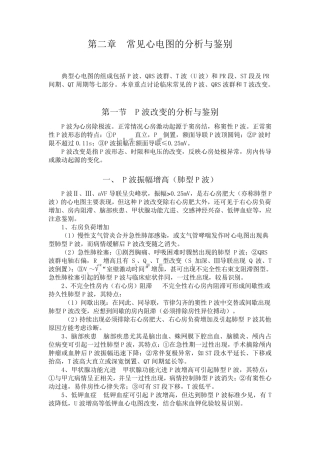常见心电图的分析与鉴定