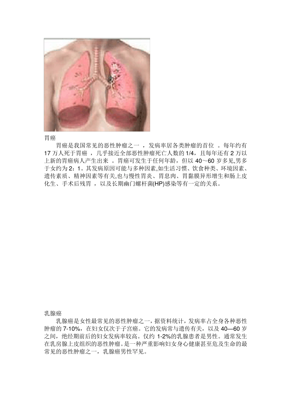 常见的10大恶性肿瘤是哪些_第2页