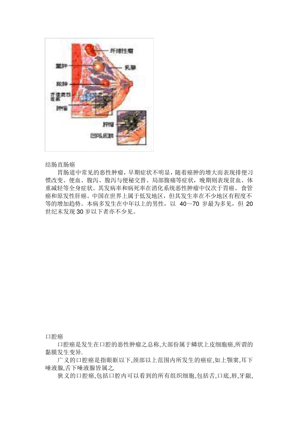 常见的10大恶性肿瘤是哪些_第3页