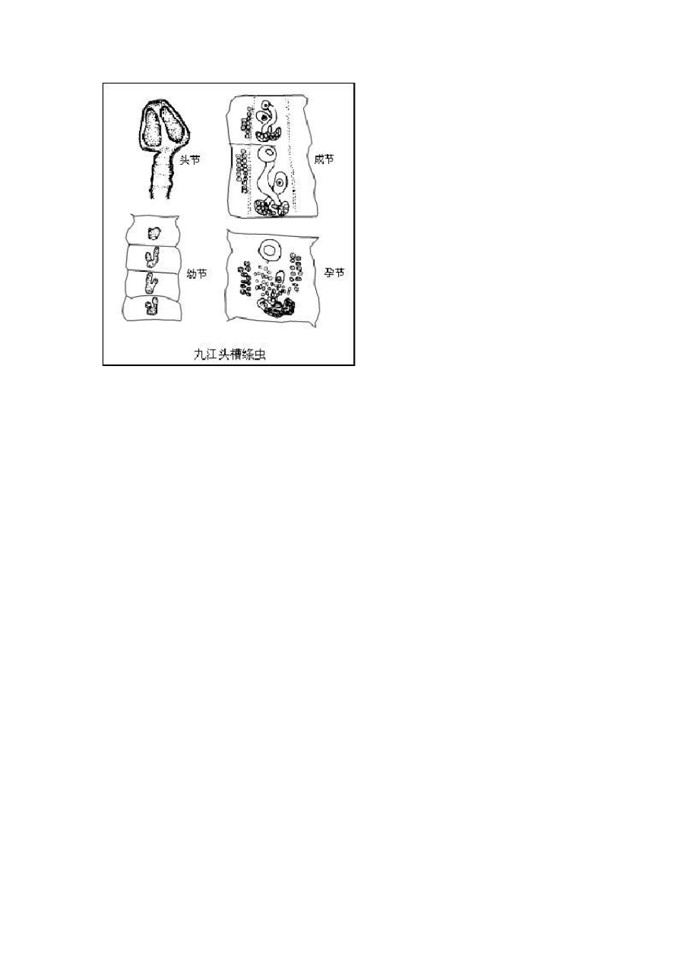 常见的鱼类寄生虫_第2页