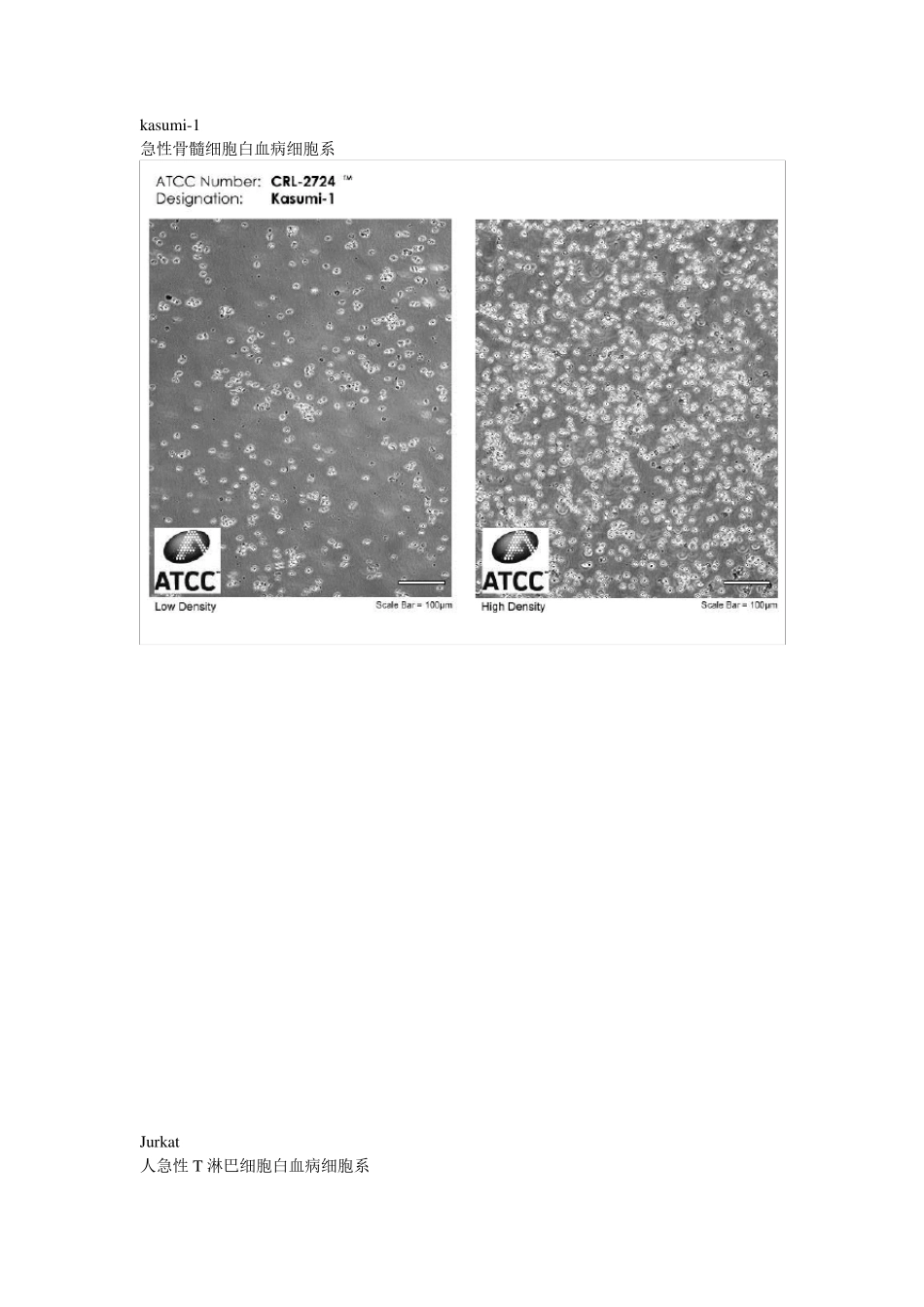 常见肿瘤细胞及其形态_第2页