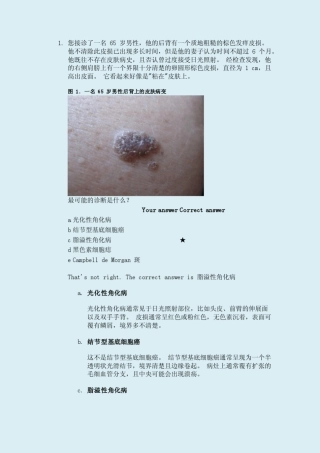 常见良性皮肤病变的主要特征、诊断和治疗