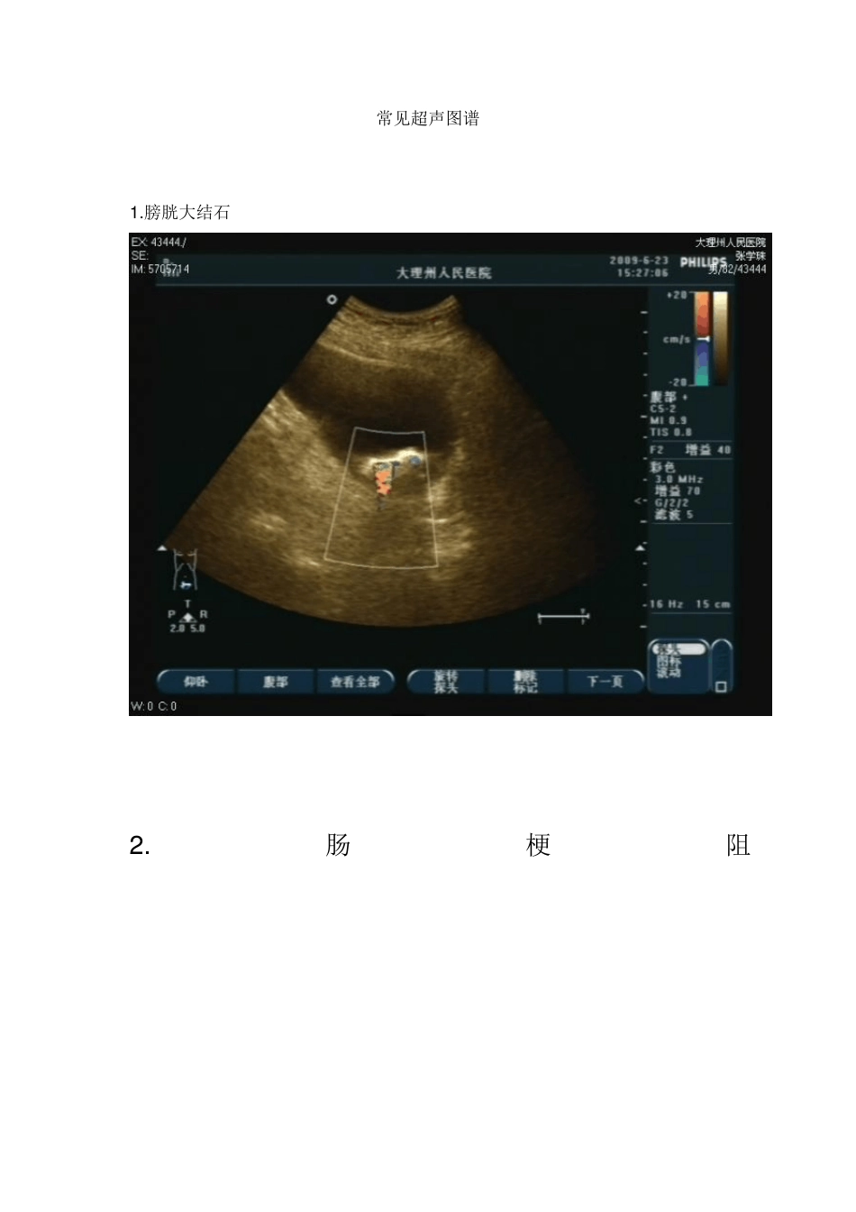 常见超声图谱_第1页