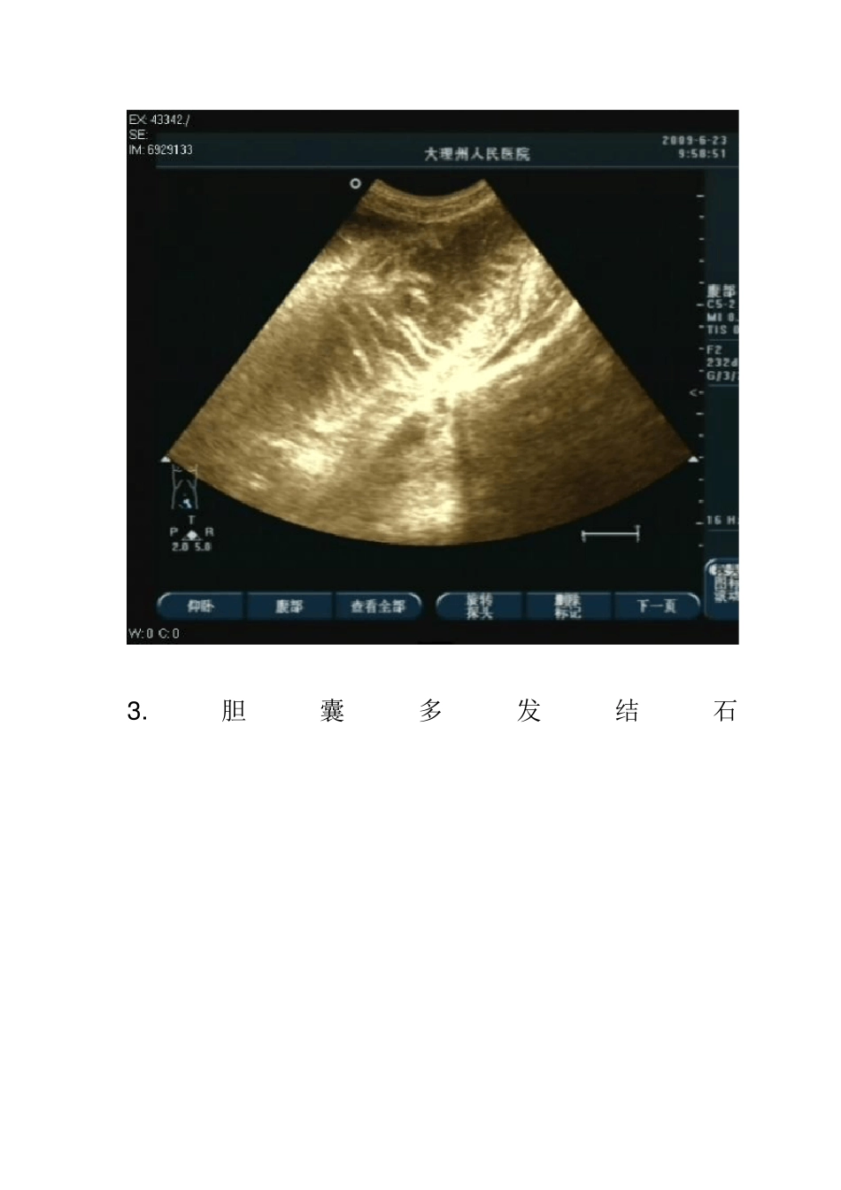 常见超声图谱_第2页