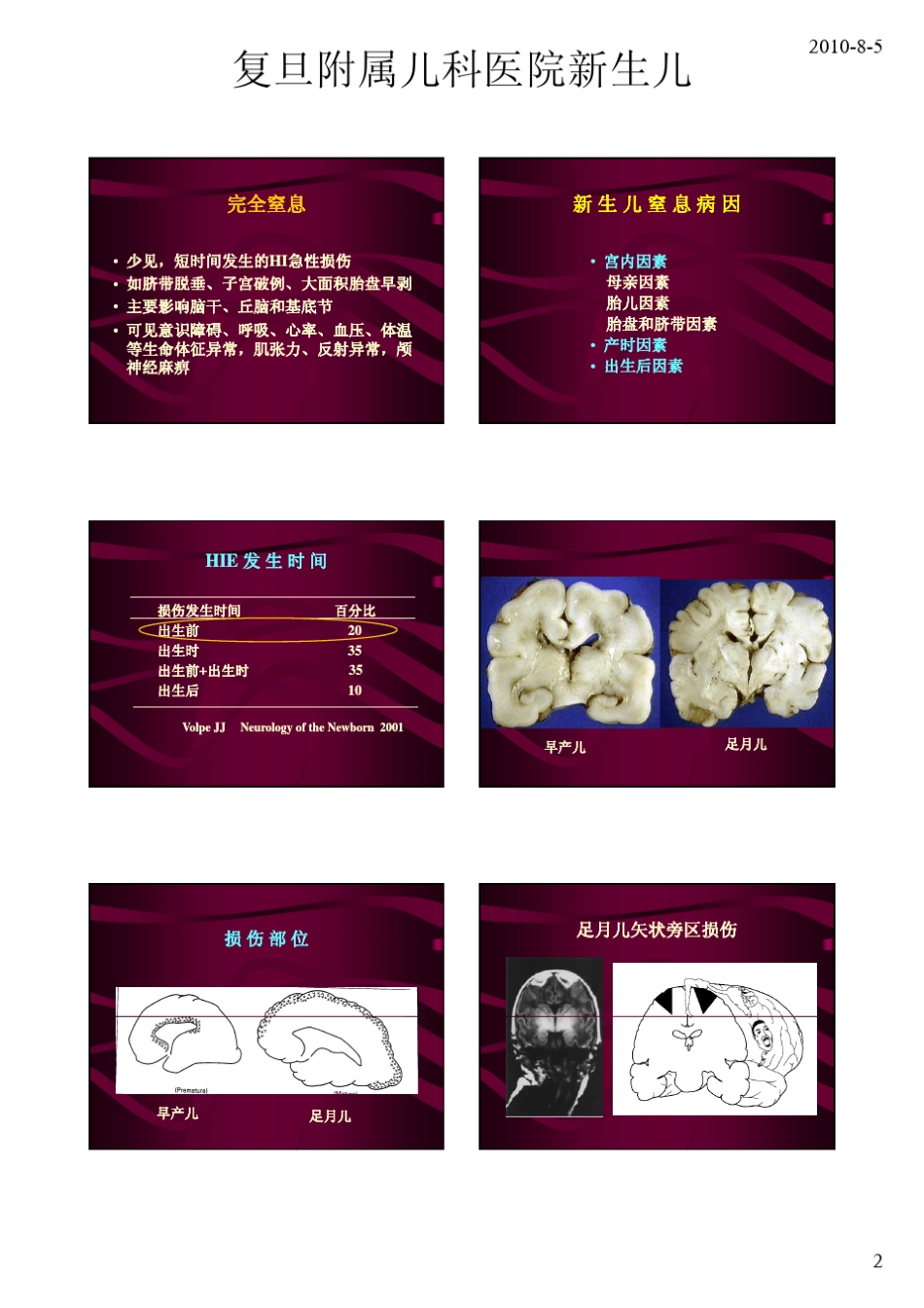 新生儿脑损伤及预后_第2页