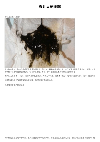 新生婴儿大便图解