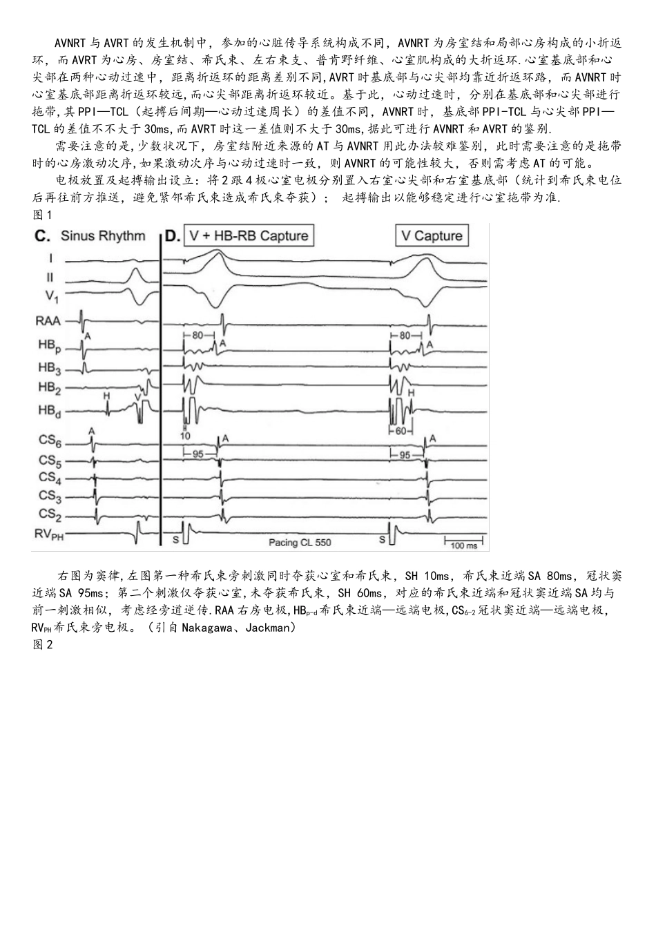 2025年室上性心动过速鉴别诊疗的常用心内电生理程序刺激方法_第2页