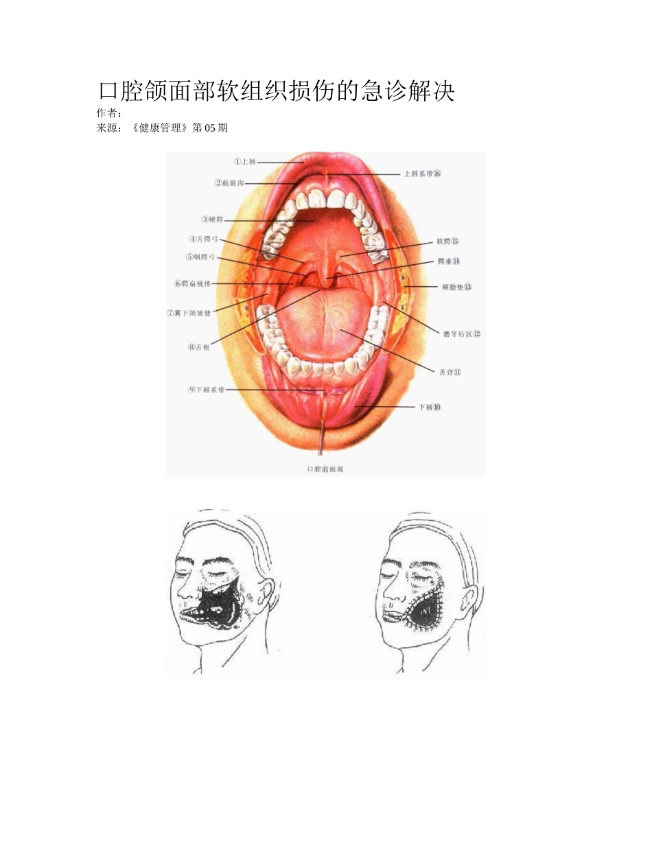 2025年口腔颌面部软组织损伤的急诊处置_第1页