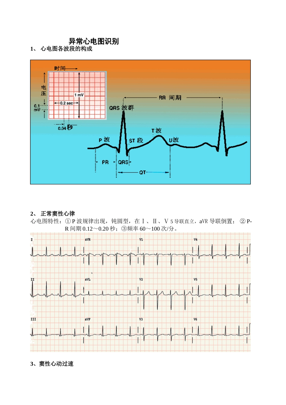 2025年异常心电图识别精_第1页