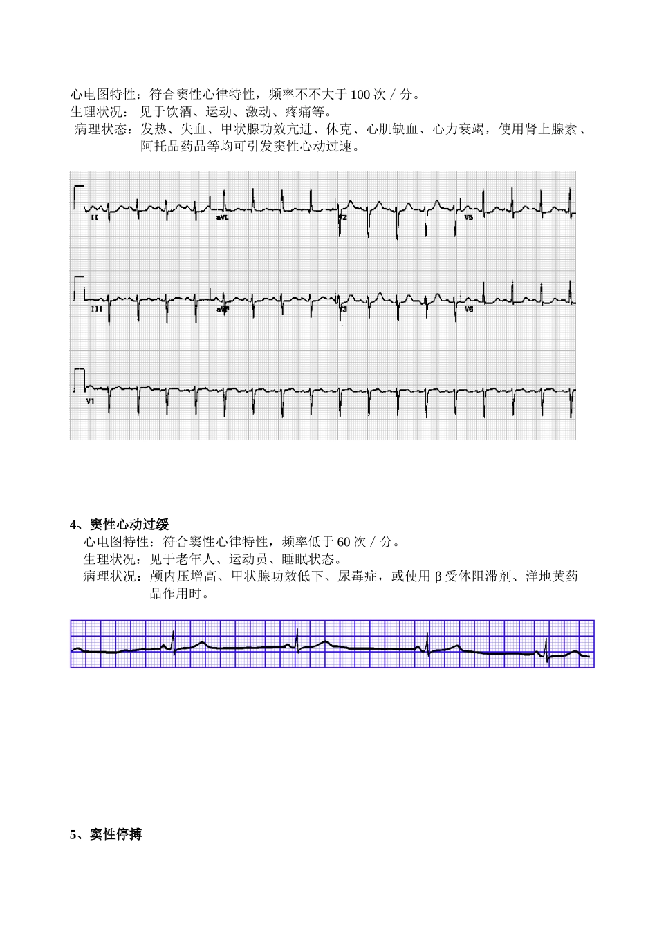 2025年异常心电图识别精_第2页