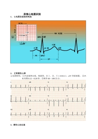 2025年异常心电图识别精