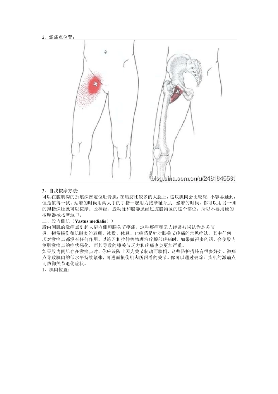 激痛点和肌肉疼痛自我按摩治疗(30)大腿内侧痛_第3页