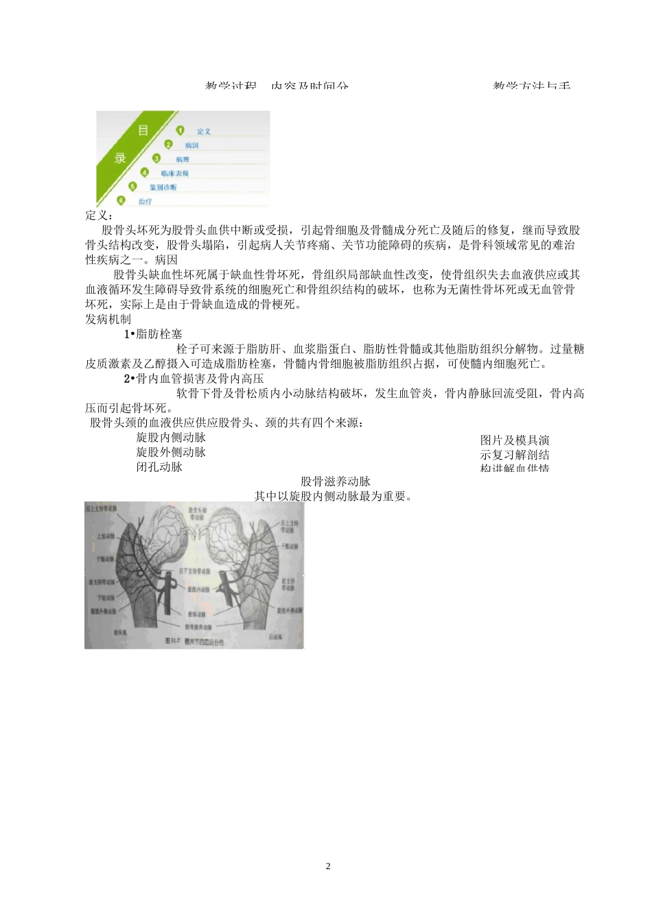 股骨头坏死教案_第2页