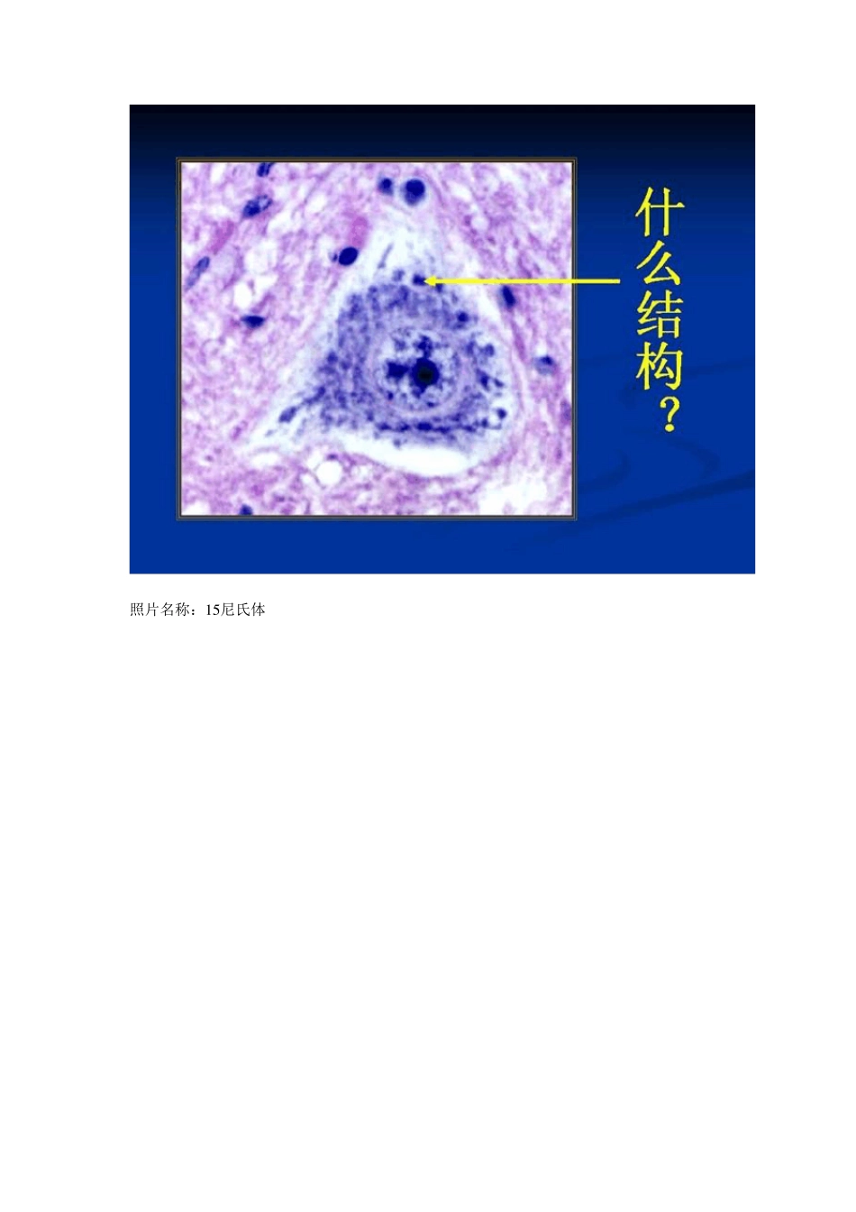 组织学与胚胎学实验考试图及答案!_第2页