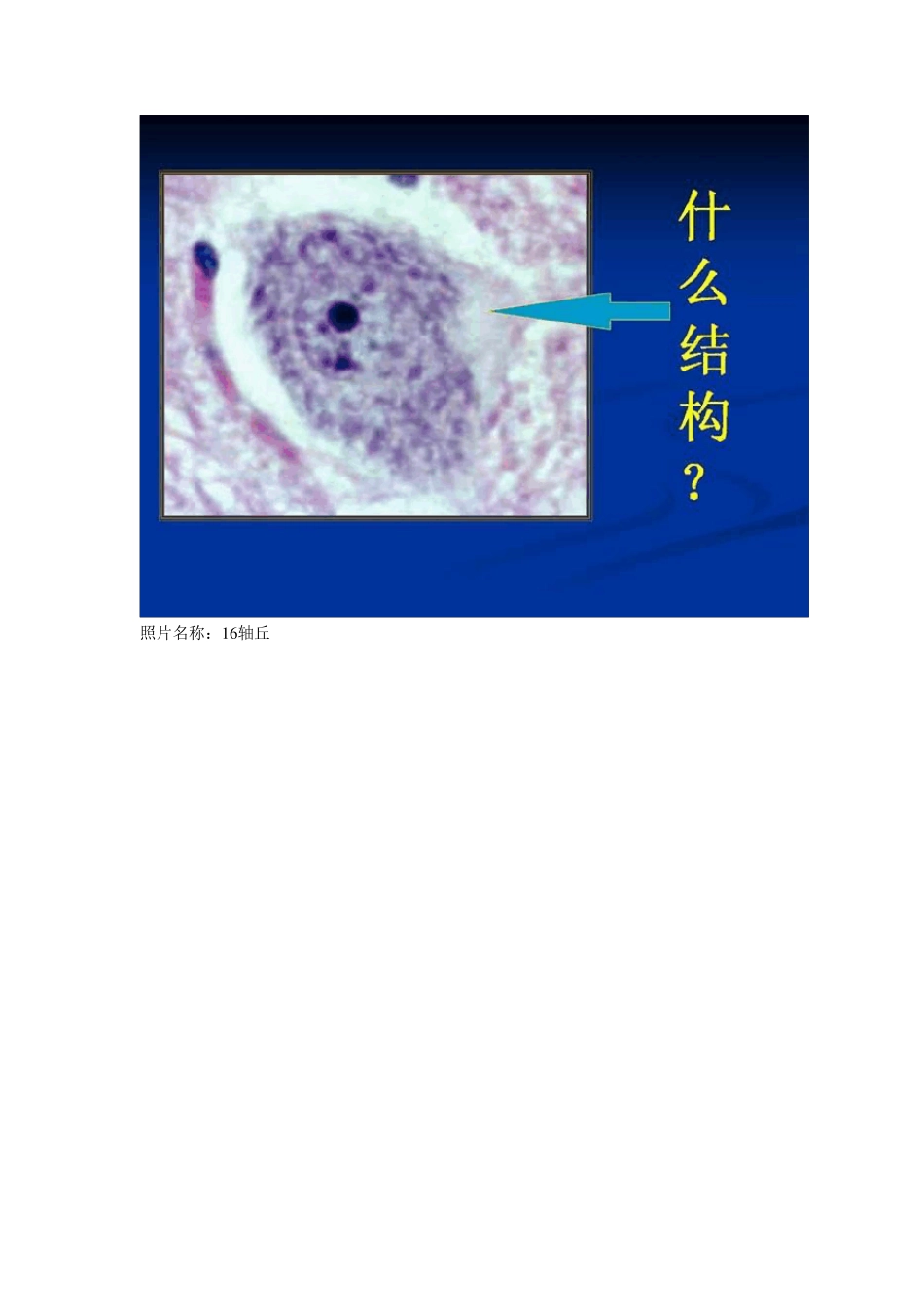 组织学与胚胎学实验考试图及答案!_第3页