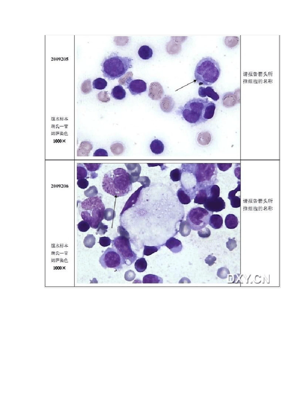 细胞形态学图片_第3页