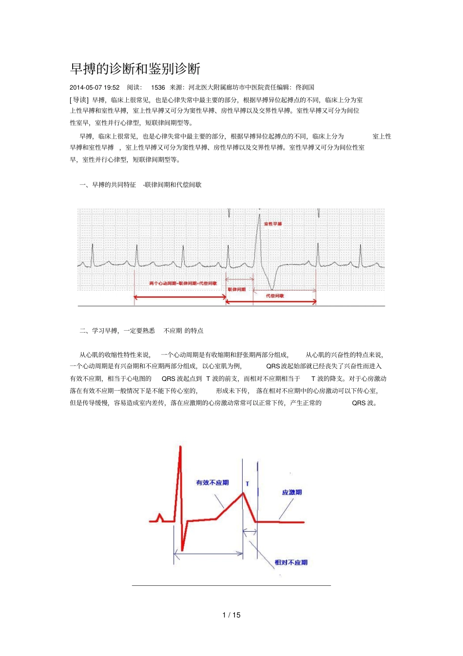 早搏诊断和鉴别诊断_第1页