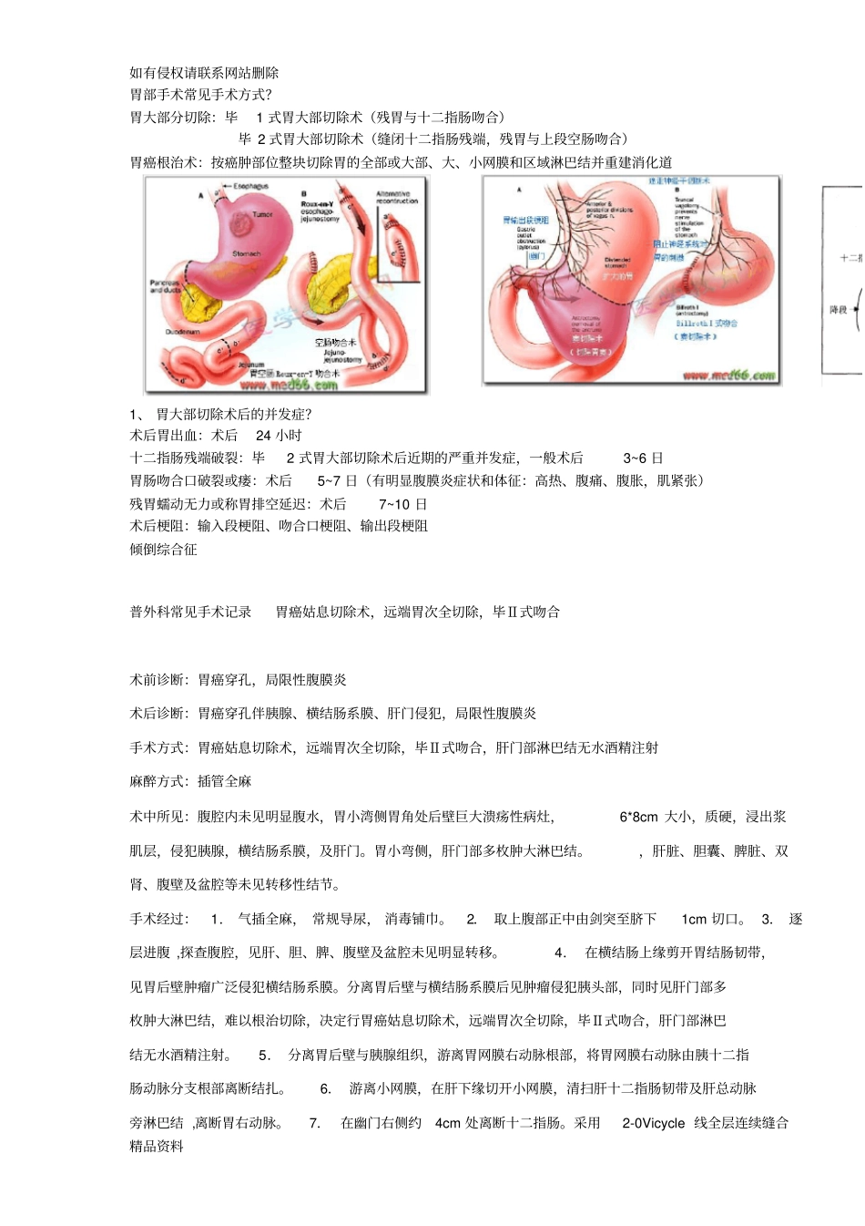 普外科所有手术记录教学教材_第1页