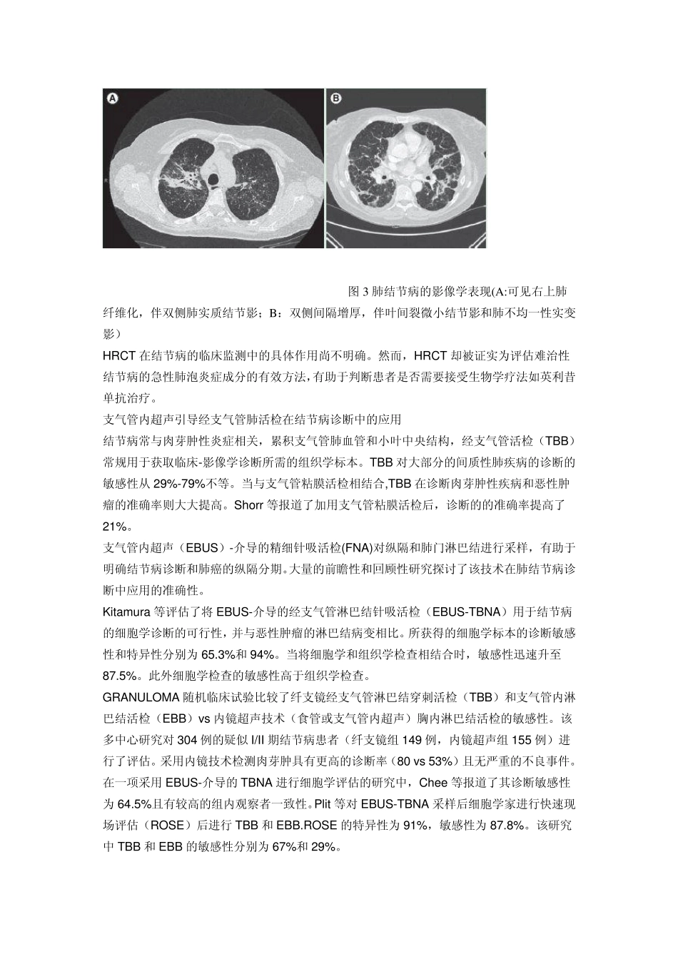 综述：肺结节病诊断治疗新进展_第3页