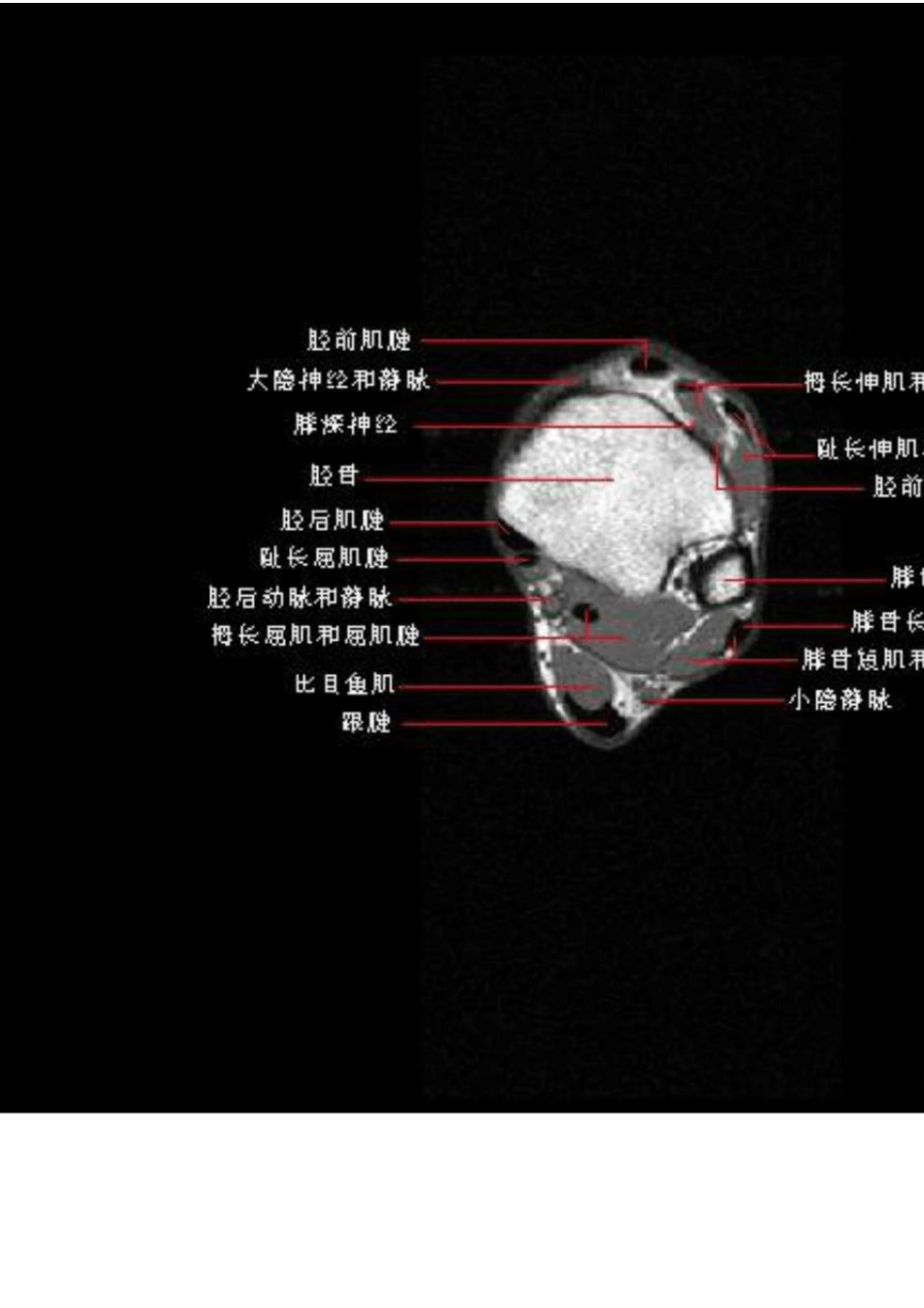 踝关节正常MRI解剖图谱_第1页