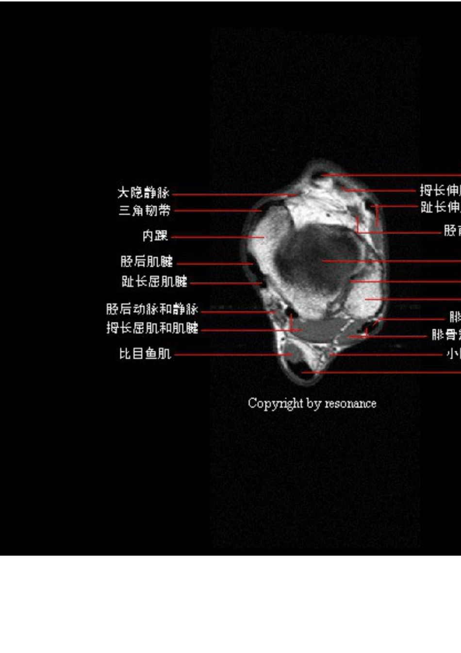 踝关节正常MRI解剖图谱_第3页