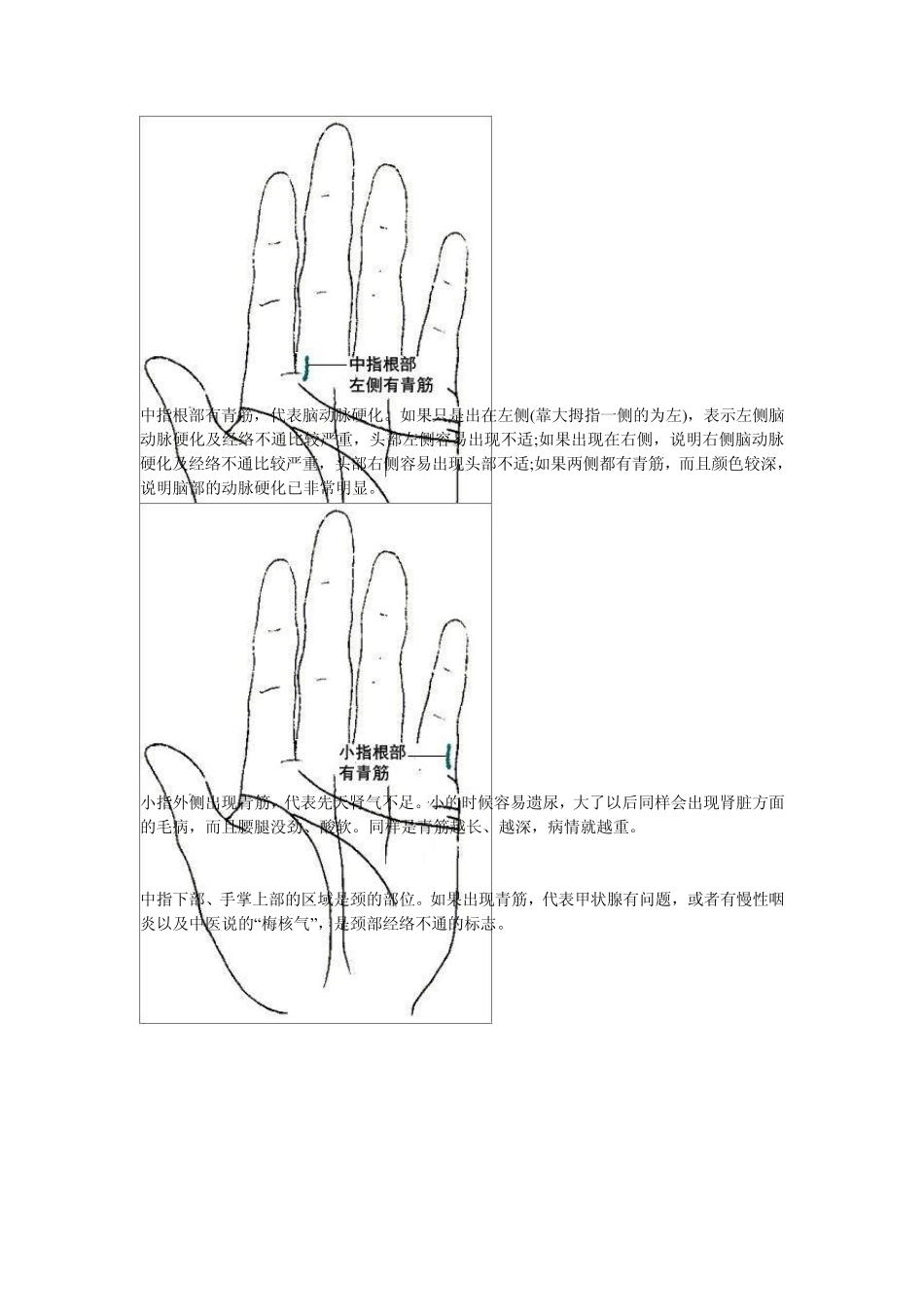 身上青筋看的见身体健康有危险_第3页
