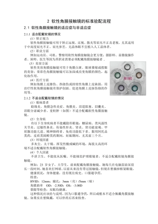 软性角膜接触镜的标准验配流程