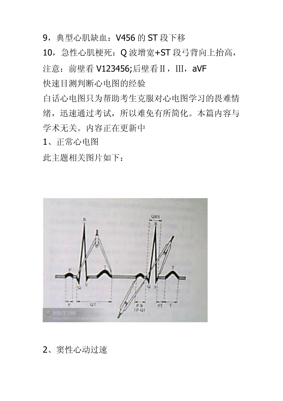 过目不忘：巧记心电图_第3页