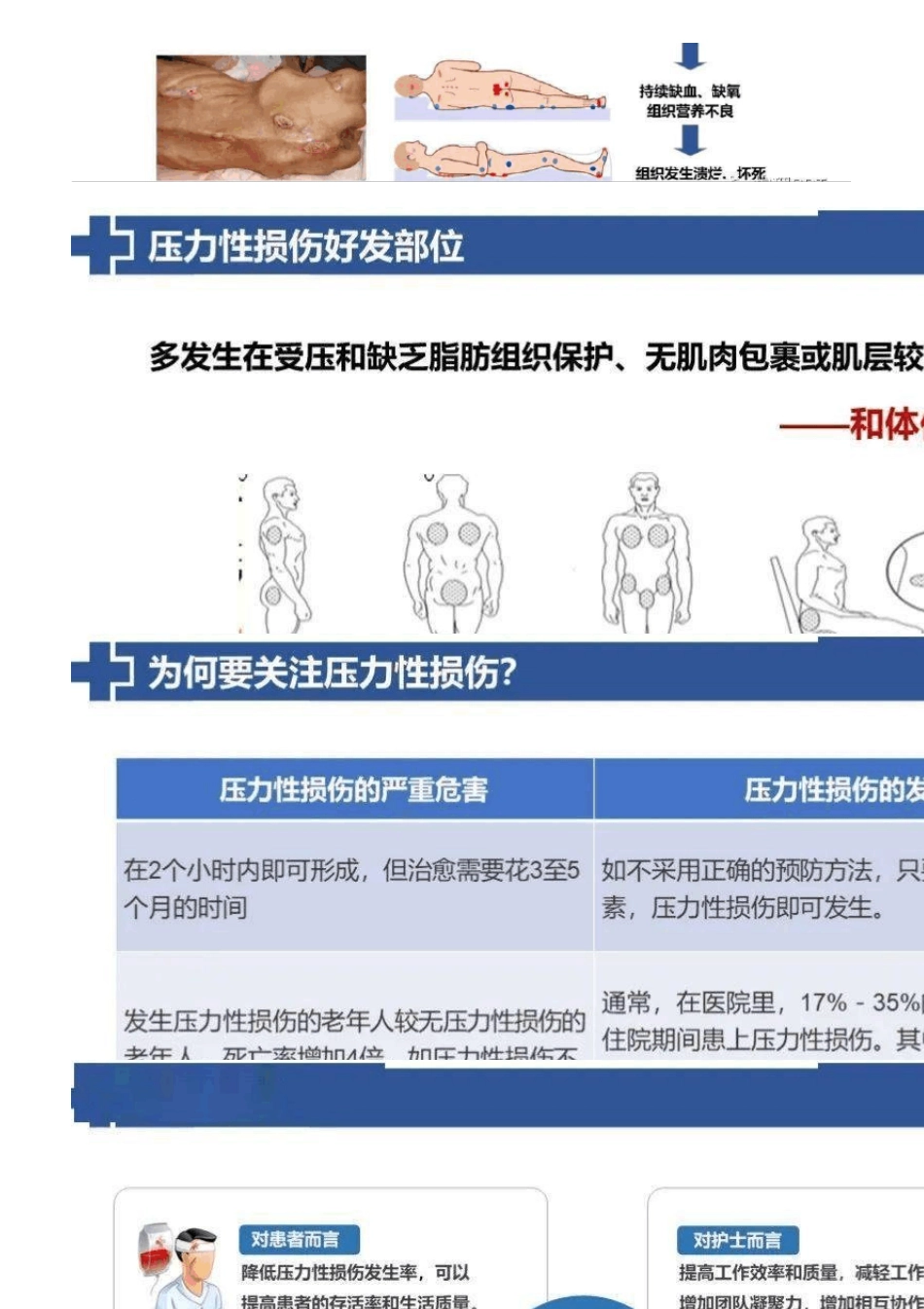 运用PDCA降低压力性损伤发生率_第3页